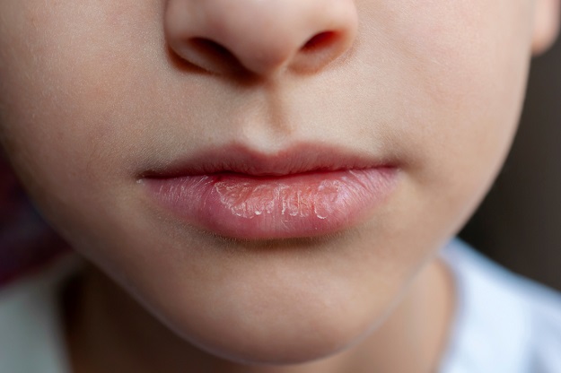 Wat Te Doen Tegen Schrale Lippen En Kapotte Handen Tipsvoorjou